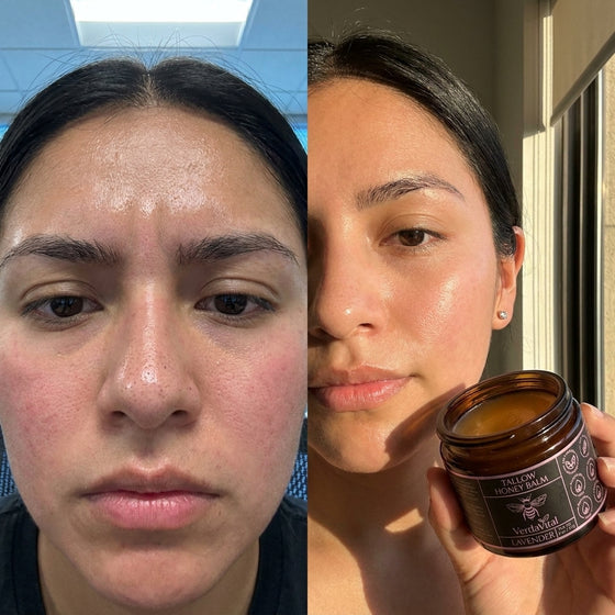 Raya, 30