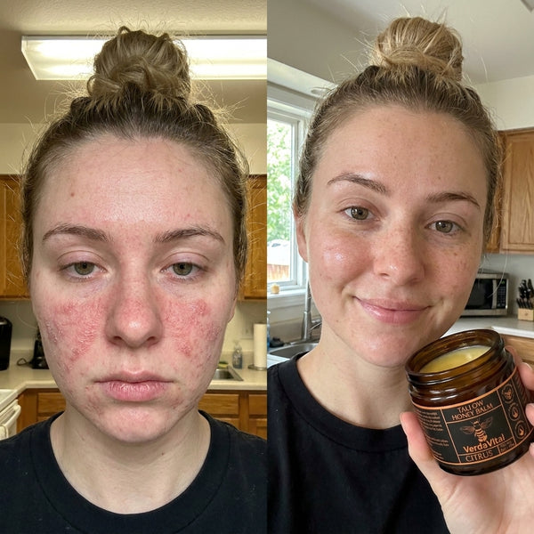 Danielle, 29
