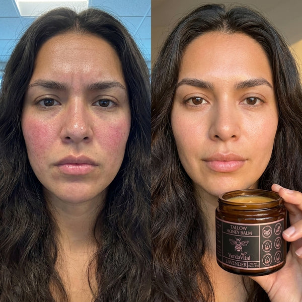 Lauren, 27