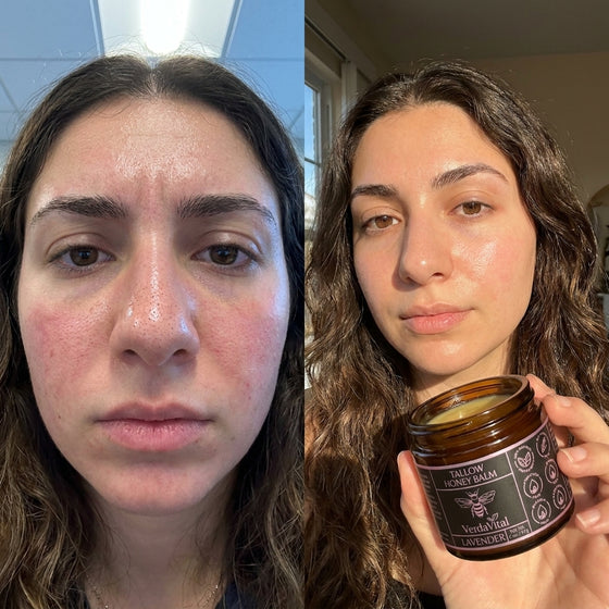 Michelle, 26