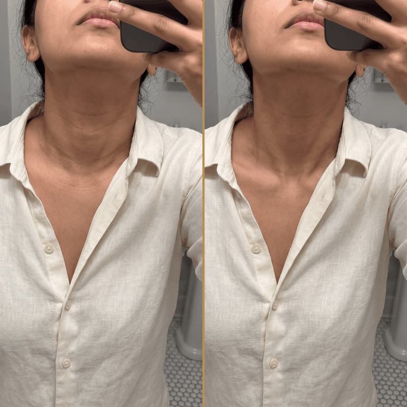 Woman checking swollen face in bathroom mirror after procedure