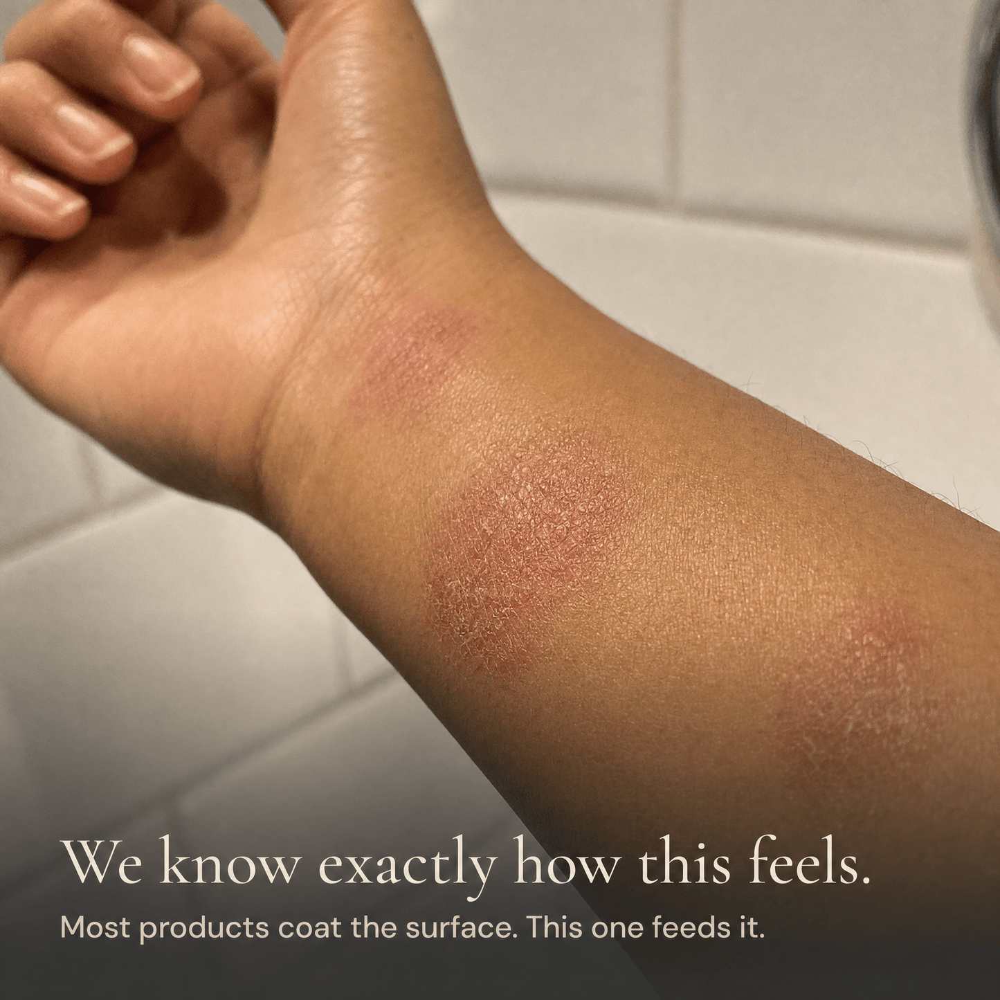 Honey Tallow Balm product detail shot — 4-ingredient barrier repair balm